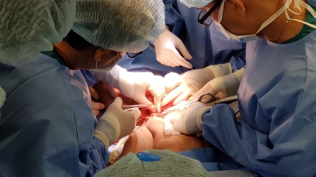 HCM City doctors separate conjoined twins