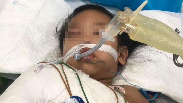 3-year-old assaulted by mothers boyfriend in intensive care